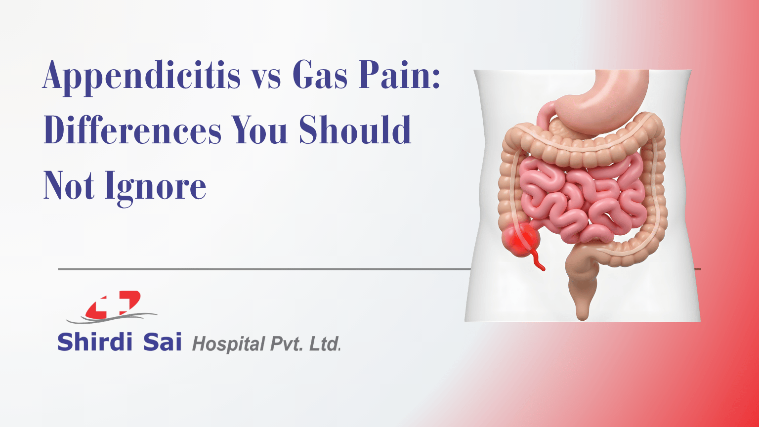 Appendicitis vs Gas Pain: Differences You Should Not Ignore