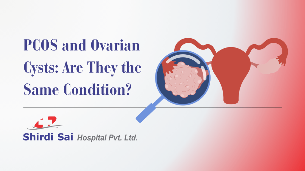 PCOS and Ovarian Cysts: Are They the Same Condition?