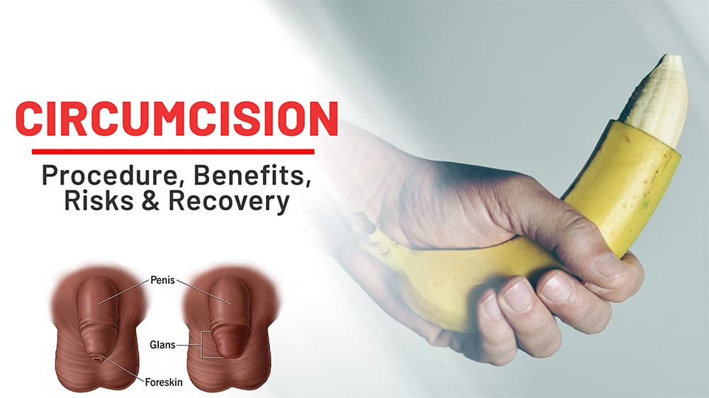 Circumcision Surgery