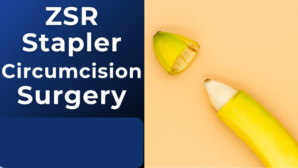 Stapler Circumcision Surgery