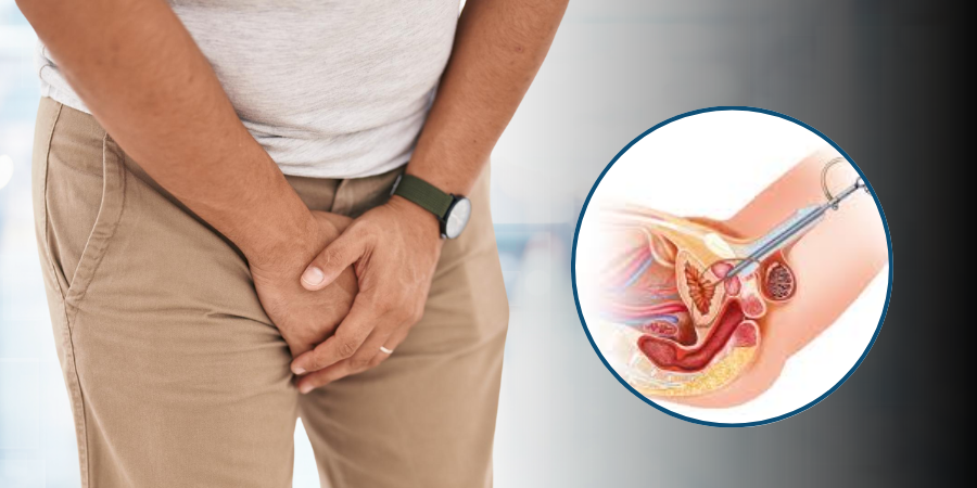 Urethral Stricture Treatment