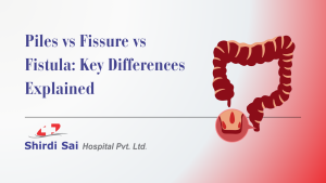 Piles vs Fissure vs Fistula: Key Differences Explained