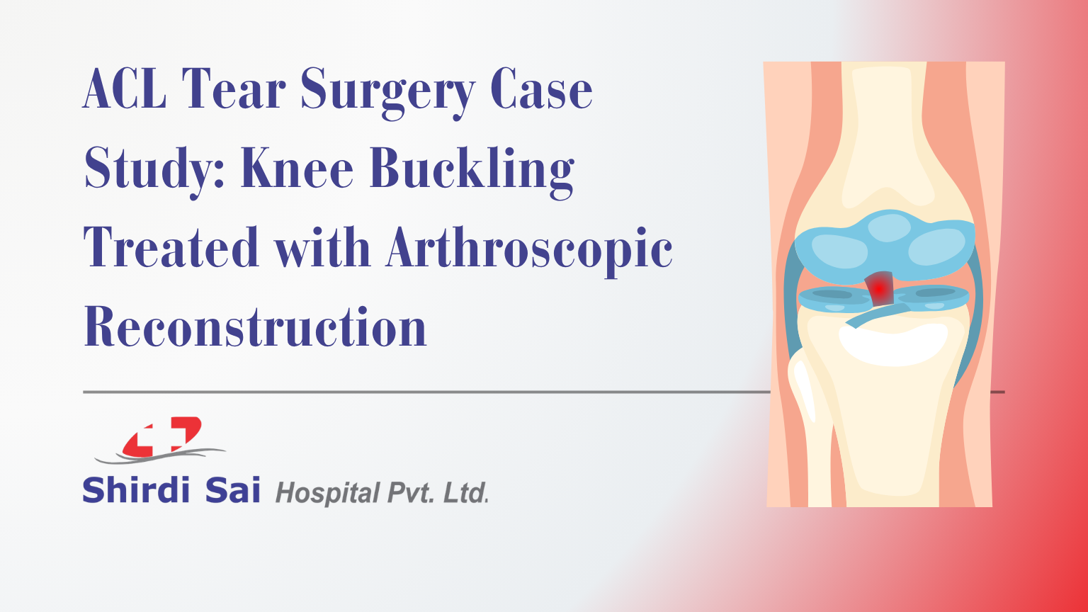 ACL Tear Surgery Case Study: Knee Buckling Treated with Arthroscopic Reconstruction