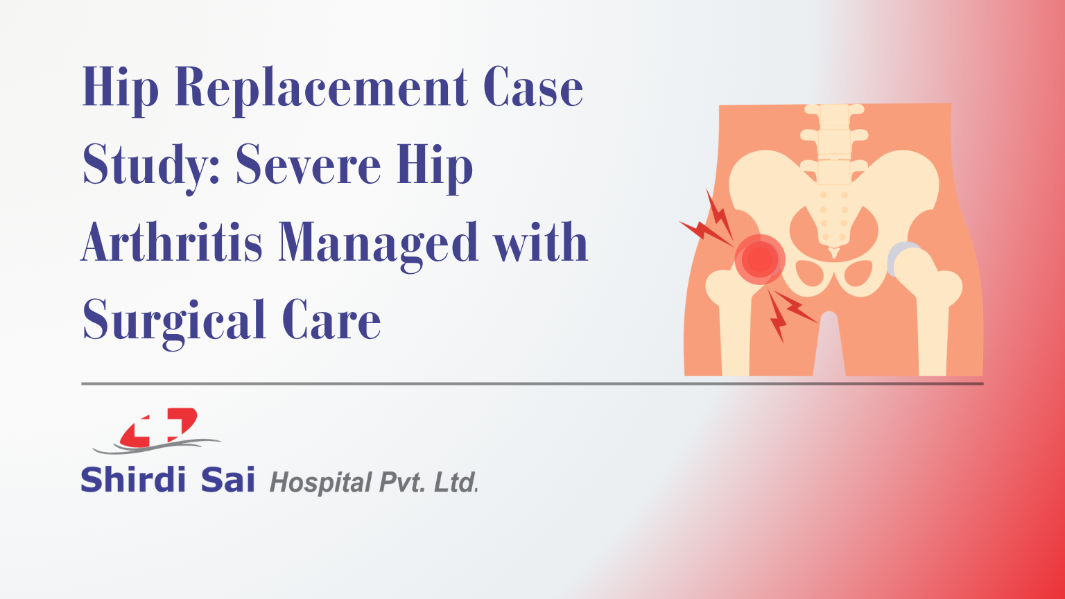 Hip Replacement Case Study: Severe Hip Arthritis Managed with Surgical Care