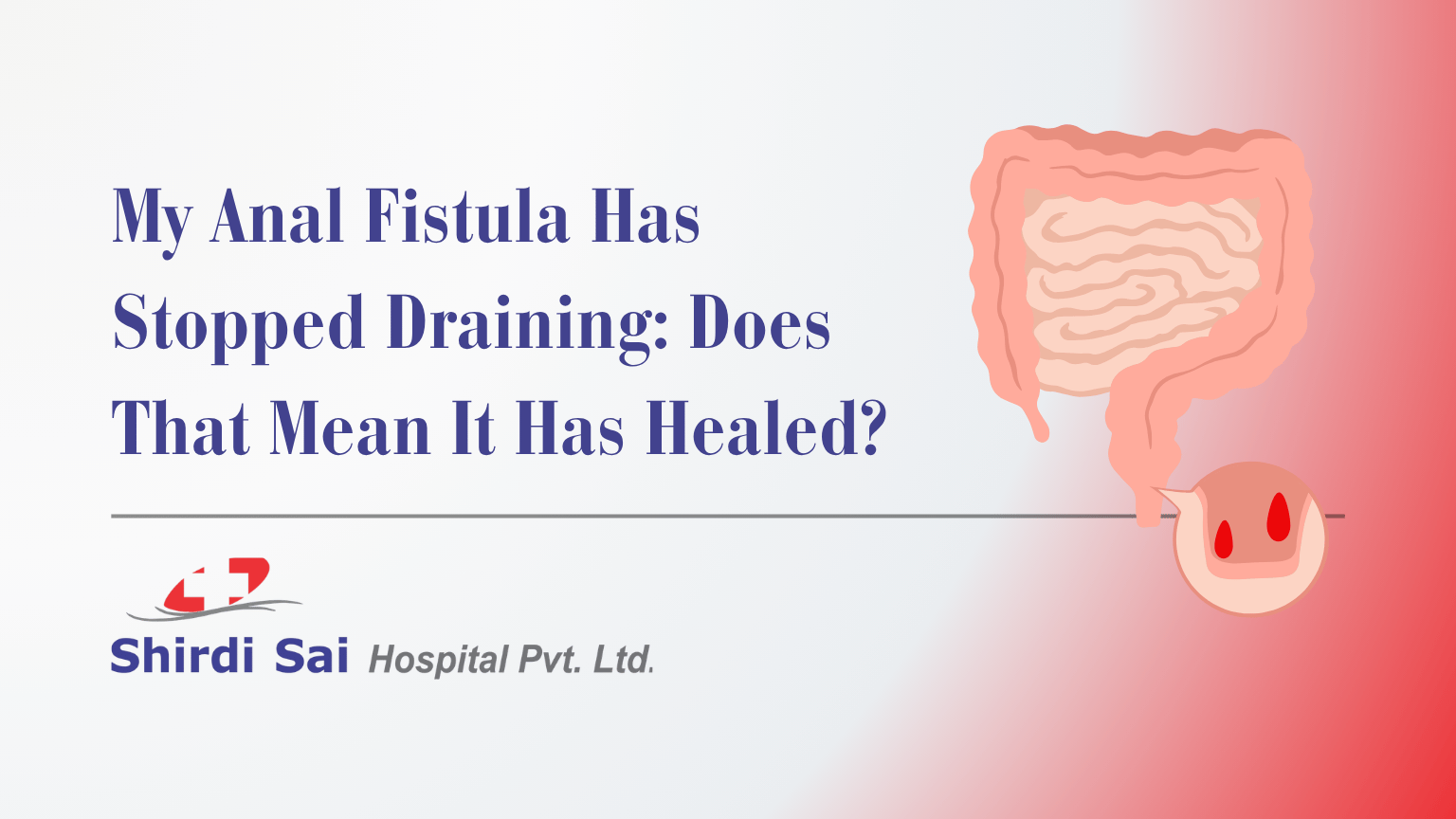 My Anal Fistula Has Stopped Draining: Does That Mean It Has Healed?