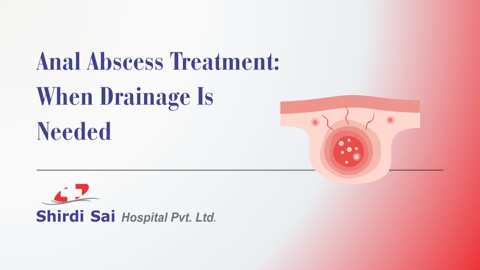 Anal Abscess Treatment: When Drainage Is Needed