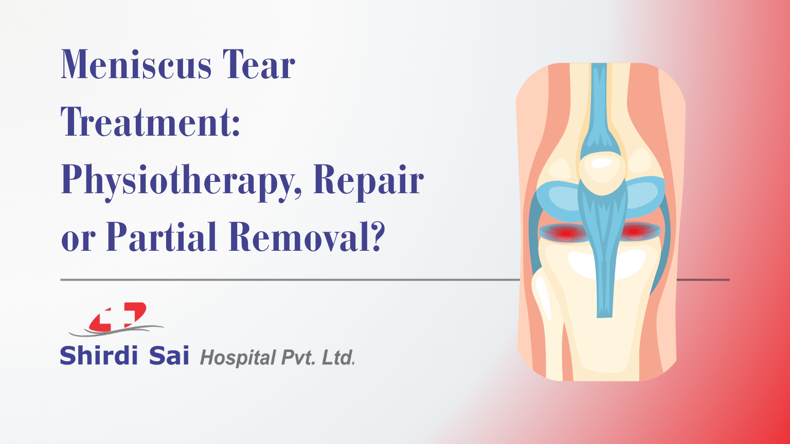 Meniscus Tear Treatment: Physiotherapy, Repair or Partial Removal?
